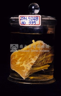 黑熊頸部藏品圖，第2張