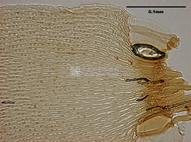 Acanthorrhynchium papillatum Collection Image, Figure 8, Total 10 Figures