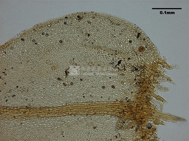 Abietinella abietina Collection Image, Figure 9, Total 10 Figures