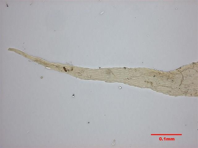 Aerobryopsis parisii (Card.) Broth. Collection Image, Figure 7, Total 10 Figures