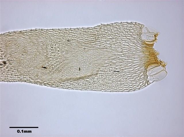 Acanthorrhynchium papillatum (Harv.) Fleisch. Collection Image, Figure 7, Total 8 Figures