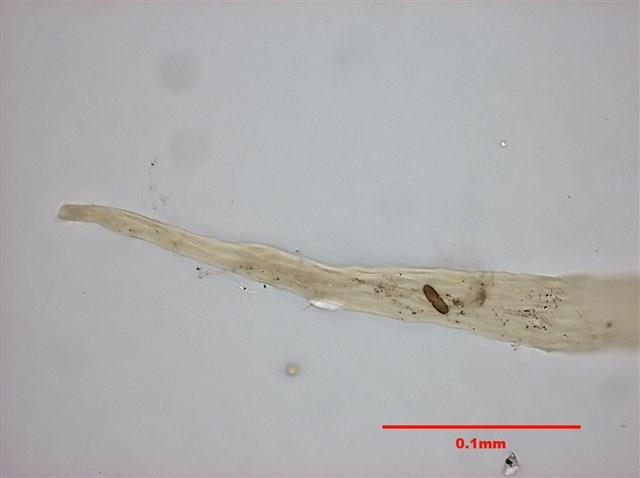 Aerobryopsis parisii (Card.) Broth. Collection Image, Figure 9, Total 10 Figures
