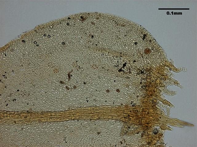 Abietinella abietina Collection Image, Figure 9, Total 10 Figures