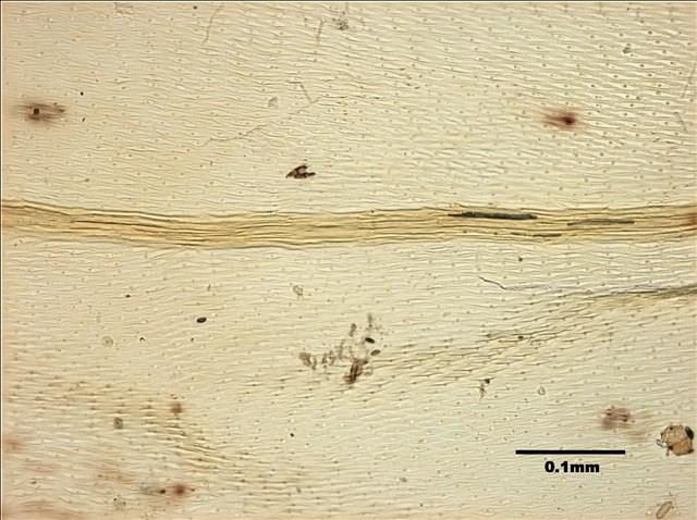 Aerobryidium taiwanense Nog. Collection Image, Figure 9, Total 10 Figures