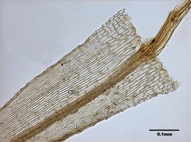 Philonotis mollis (Dozy et Molk.) Mitt. Collection Image, Figure 17, Total 20 Figures