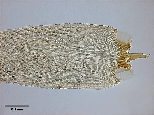 Acanthorrhynchium papillatum (Harv.) Fleisch. Collection Image, Figure 9, Total 11 Figures