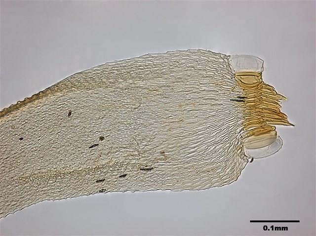 Acanthorrhynchium papillatum (Harv.) Fleisch. Collection Image, Figure 7, Total 8 Figures