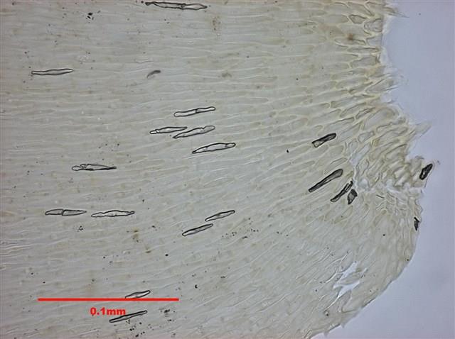 Aerobryopsis parisii (Card.) Broth. Collection Image, Figure 10, Total 10 Figures