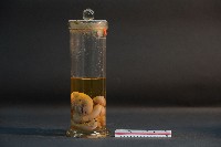 豬的胚胎藏品圖，第4張